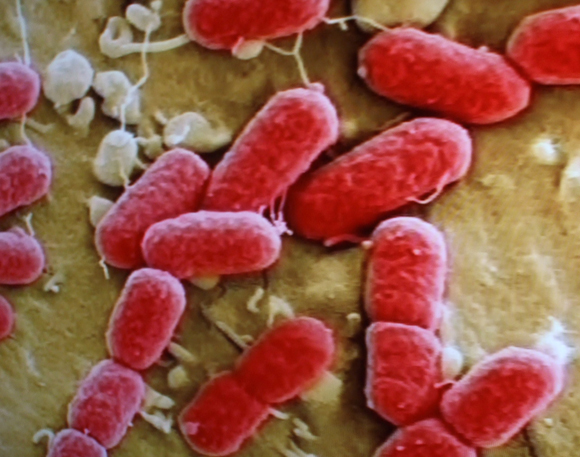 Coli_bakterium1_hasmenes