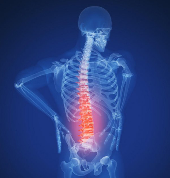 fajdalom_gerinc_derek_rontgen