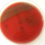 Streptococcus_tigurinus_uj_bakterium