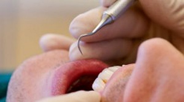 fog_foghuzas_fogkezeles