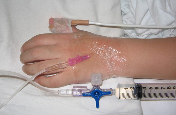 eutanazia_belgium_2014_gyermekek