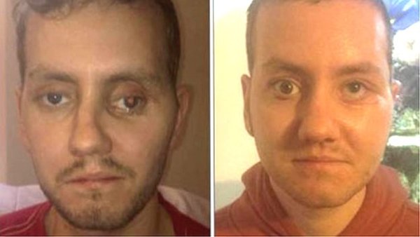 3d_arcnyomtatas_arcrekonstrukcio_tudomany