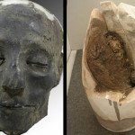 akut_szivelegtelenseg_mumia_legregebbi_eset