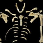 leukemia_legregebbi_eset_7000ev